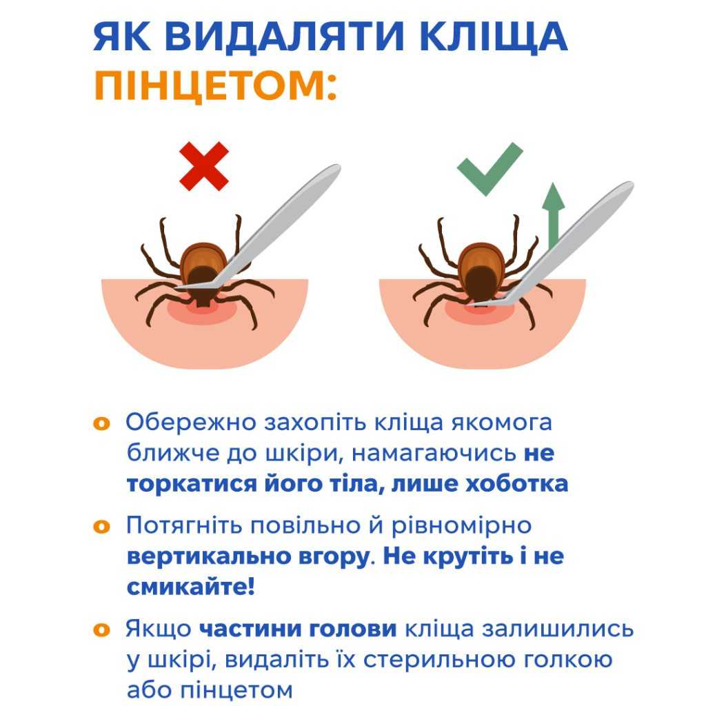 Почався сезон кліщів: поради, як уберегтися, як витягати, куди звертатися після укусу